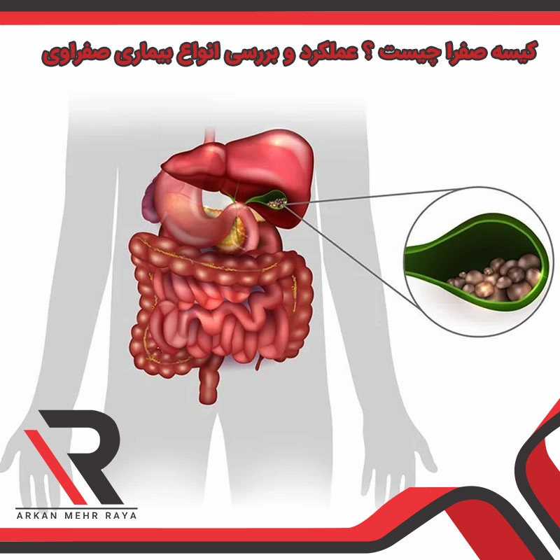 کیسه صفرا چیست ؟عملکرد و بررسی انواع بیماری صفراوی